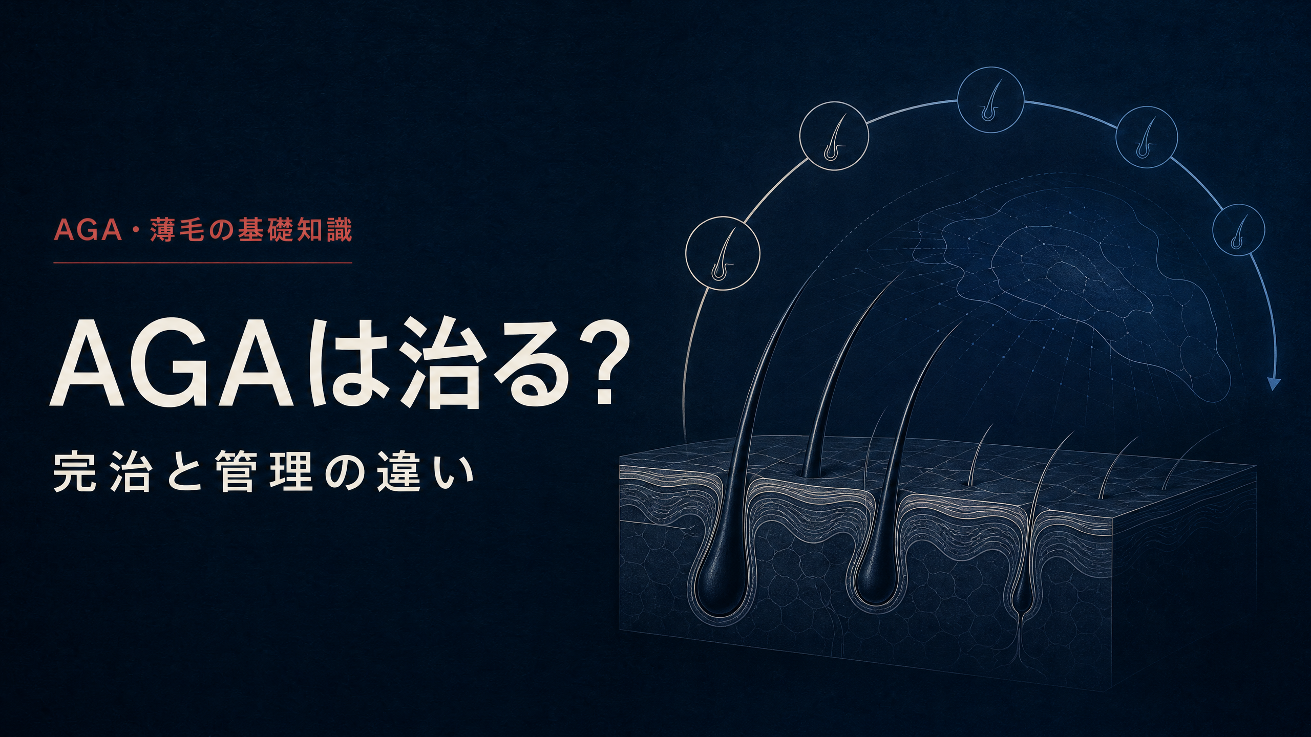 毛根と管理を示す「AGAは治る？」のアイキャッチ