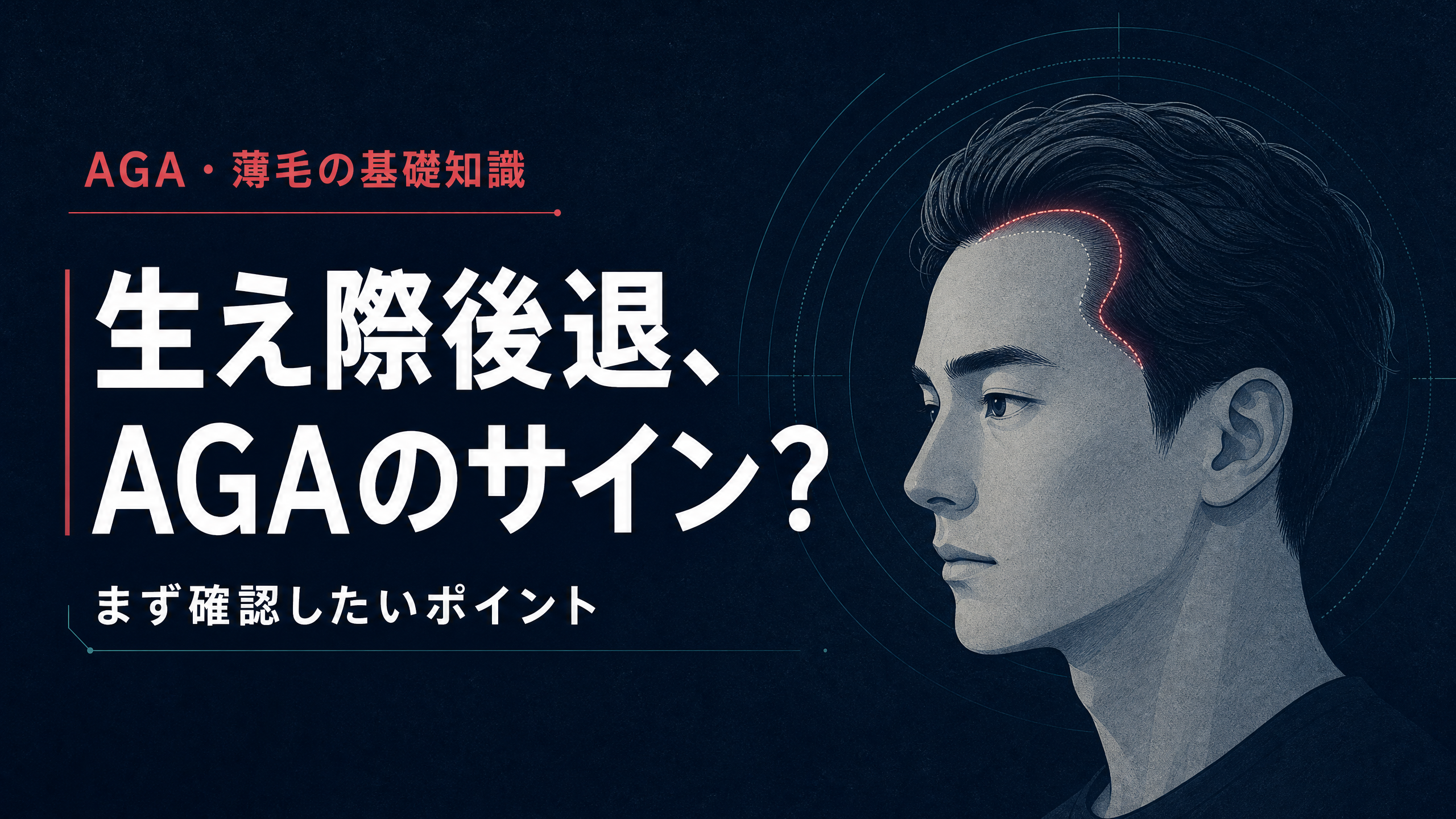 生え際後退とAGAのサインを示す頭部のイラスト